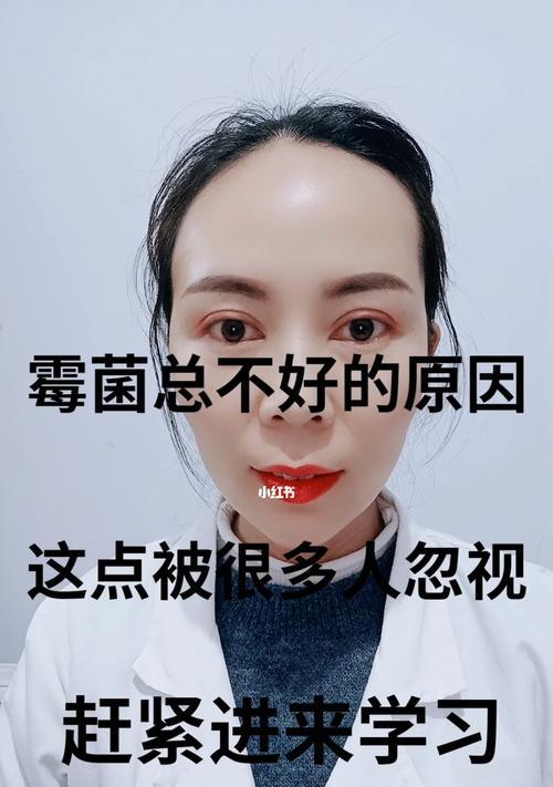 电冰箱霉菌清除方法（彻底去除索伊冰箱内的霉菌）